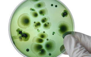 Bacteriological Culture Methods