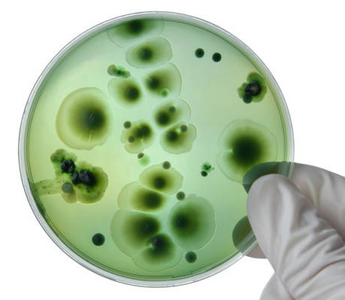 Bacteriological Culture Methods