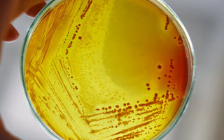 A person holding an agar filled petri dish