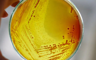 A streaked petri dish